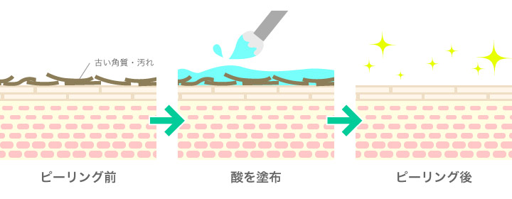 効果を発揮するメカニズム