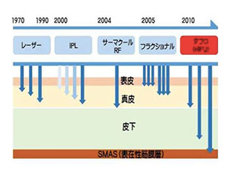 ダブロゴールド 図3