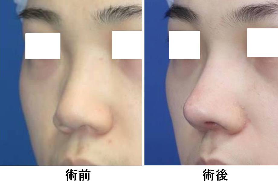 美容外科ガイド 銀座s美容 形成外科クリニック